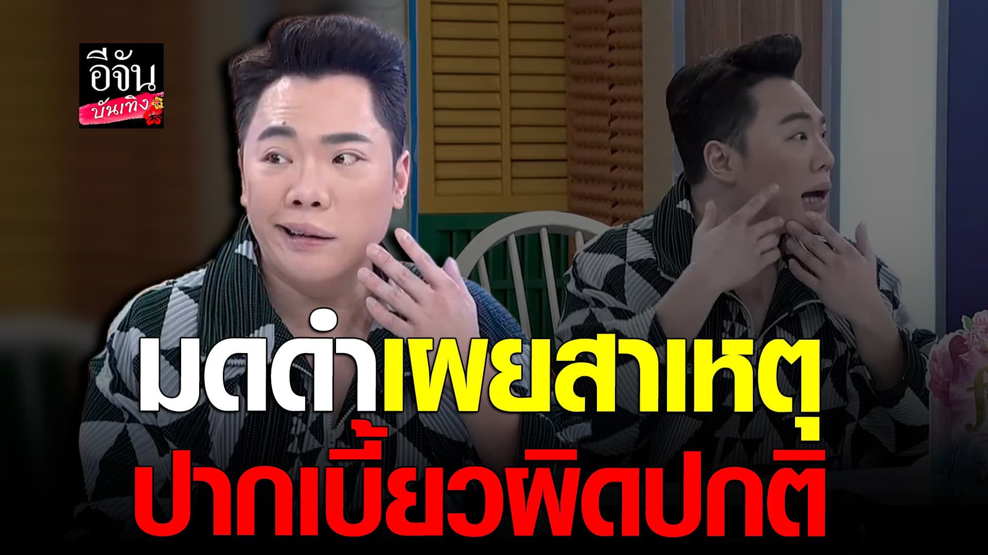 🎬 คลิปบันเทิง : มดดำ เผยสาเหตุปากเบี้ยว  ยันไม่ใช่เพราะทำฟัน