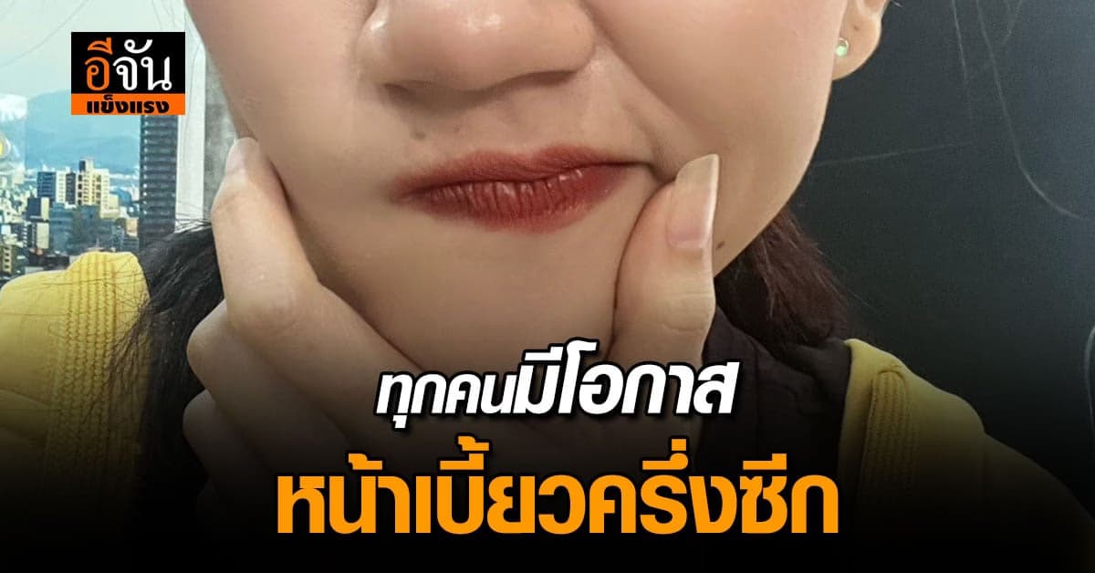 ทุกคนมีโอกาสเป็น “โรคใบหน้าเบี้ยวครึ่งซีก”