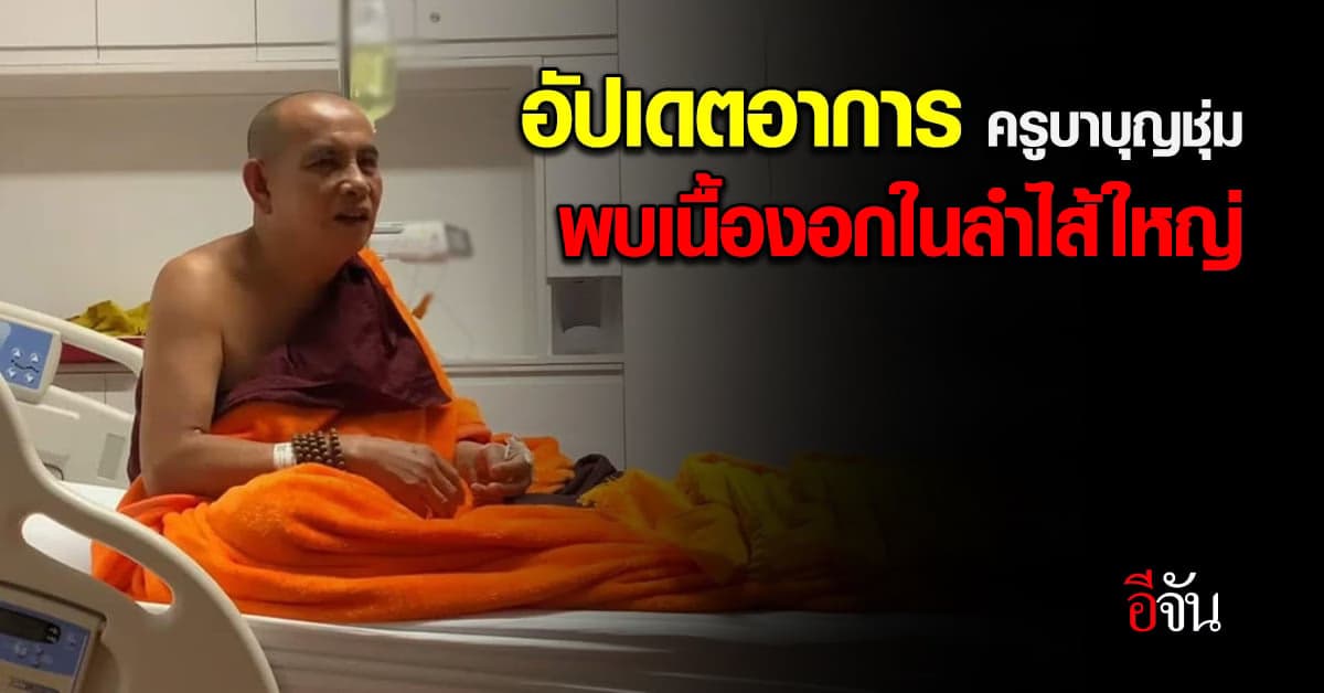 อัปเดตอาการอาพาธล่าสุด ของ ครูบาบุญชุ่ม มีเนื้องอกในลำไส้ใหญ่