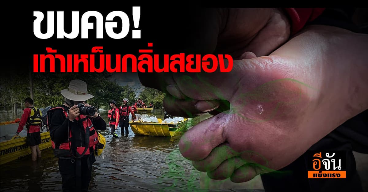 วิกฤตหน้าฝน เดินลุยน้ำจนเท้าเหม็นอับ