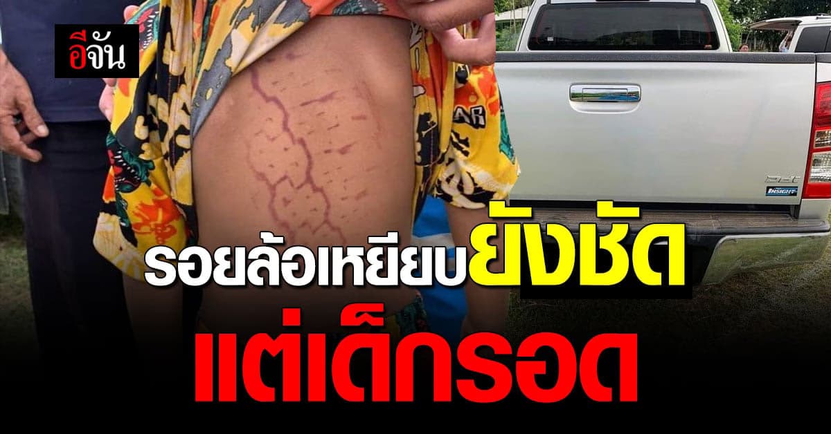 กระบะถอยหลัง ทับเด็กชายได้รับบาดเจ็บ ในโรงเรียน