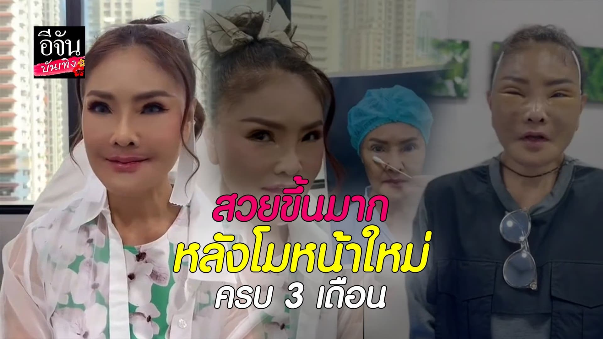 🎬 คลิปบันเทิง : ดาว มยุรี ตัดสินใจโมหน้าใหม่ ไฉไลกว่าเดิม