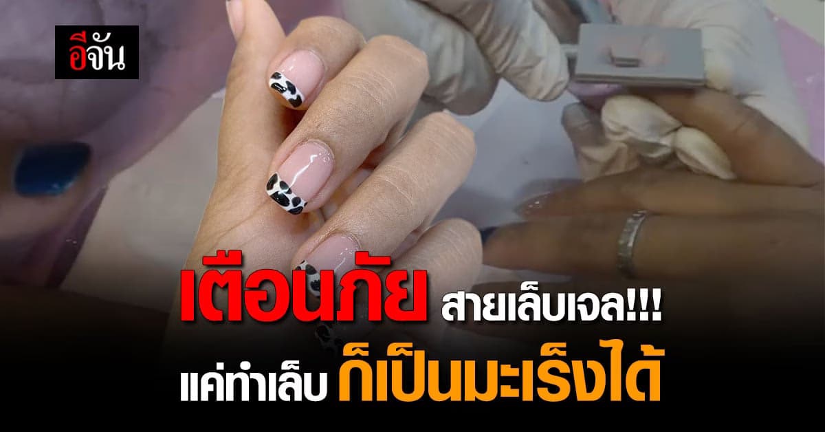 ทำไงดี! วงการเล็บเจลระวัง เครื่องอบเล็บทำเป็นมะเร็งผิวหนัง