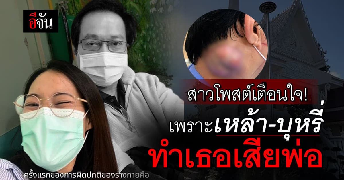 บีบหัวใจ! สาวแชร์วิทยาทาน เรื่องราวการป่วย มะเร็งโคนลิ้น ของคุณพ่อ