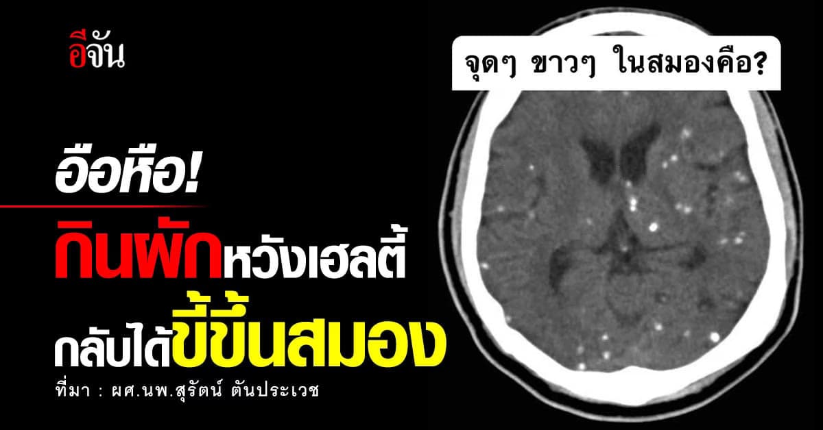 อึ้ง! เอกซเรย์สมองเจอพยาธิตัวตืดเพียบ