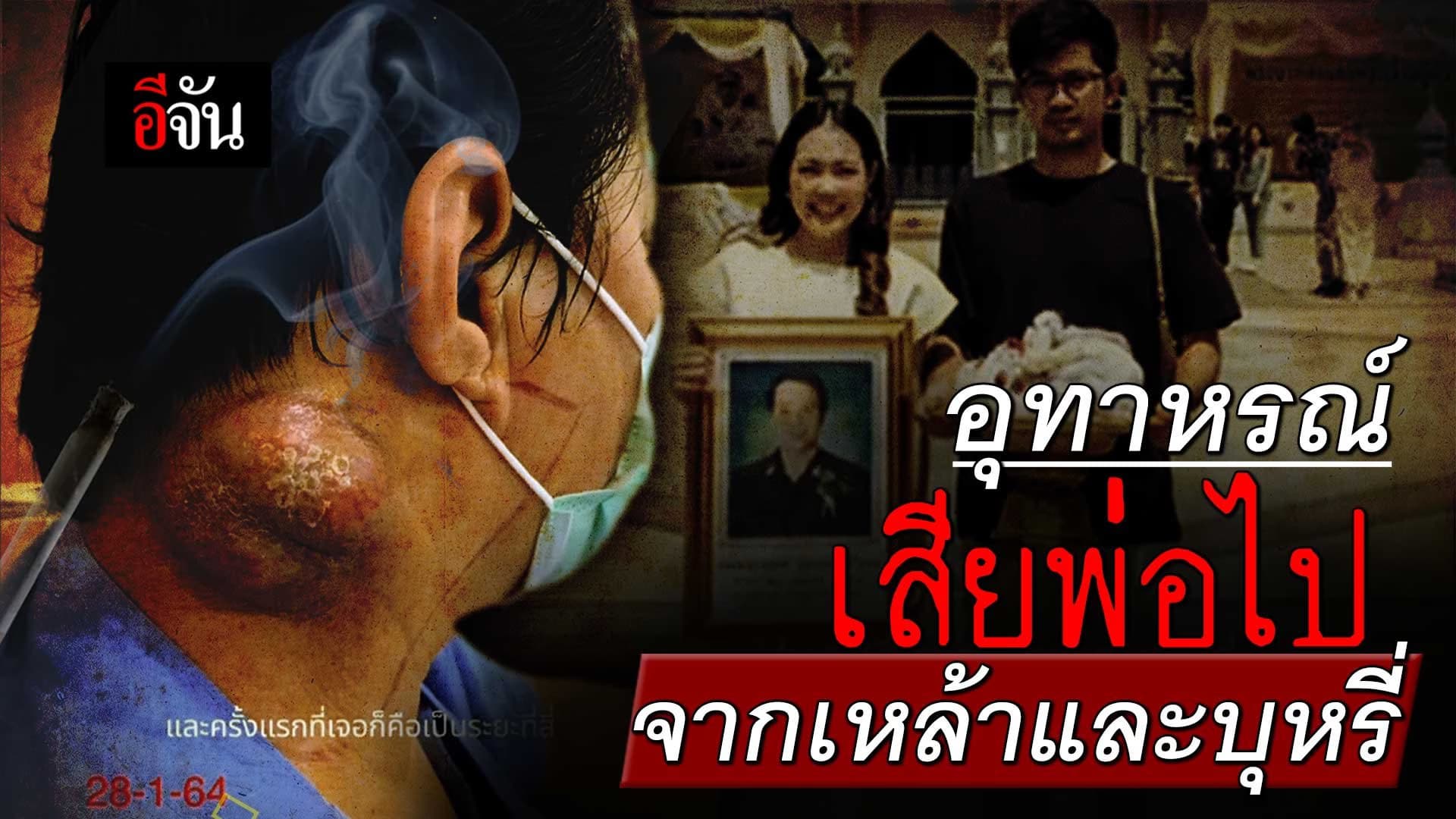 🎬 อุทาหรณ์ มะเร็งโคนลิ้น เสียพ่อไปจากเหล้า และบุหรี่