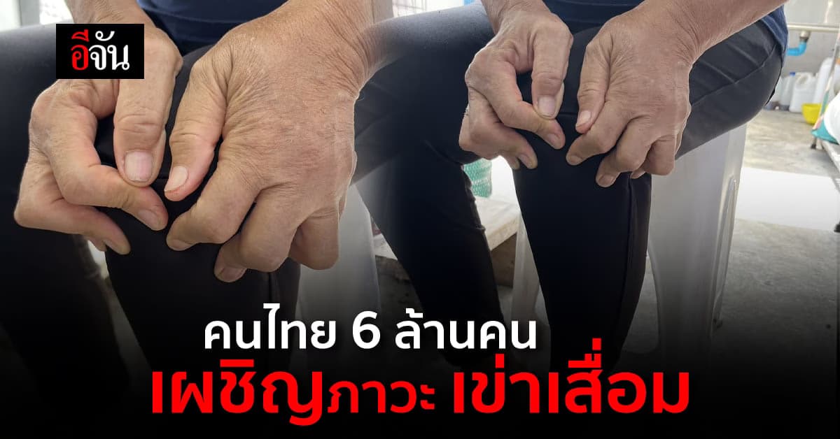 คนไทย 6 ล้านคนเป็น โรคเข่าเสื่อม หลีกเลี่ยงท่าทางนี้เพื่อช่วยถนอมเข่า