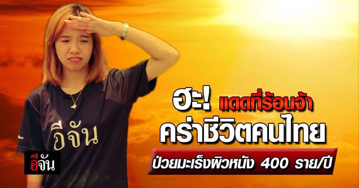 แดดที่ร้อนจ้า ฉุดคนไทยป่วยมะเร็งผิวหนัง 400 ราย/ปี จาก 1.6 แสนทั่วโลก