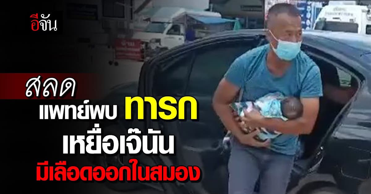 ช่วยส่งกำลังใจให้น้องมอส ทารกที่ขโมย แพทย์พบมีเลือดออกในสมองจำนวนมาก