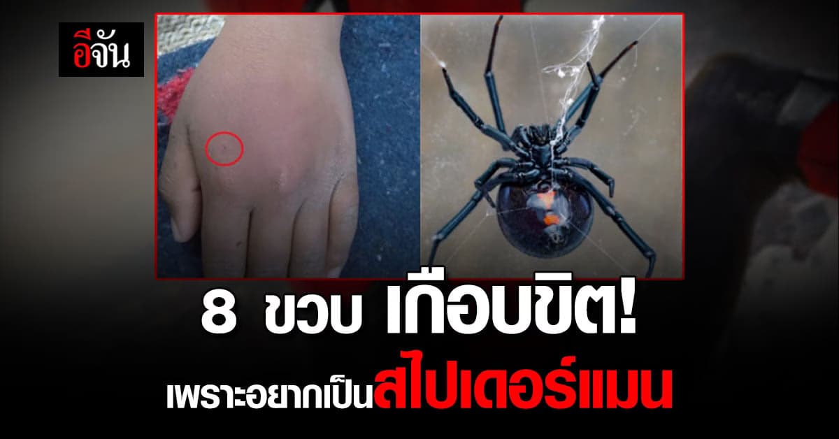 เด็ก 8 ขวบ จับแมงมุมแม่ม่ายดำกัดตัวเอง เชื่อจะเป็นสไปเดอร์แมน