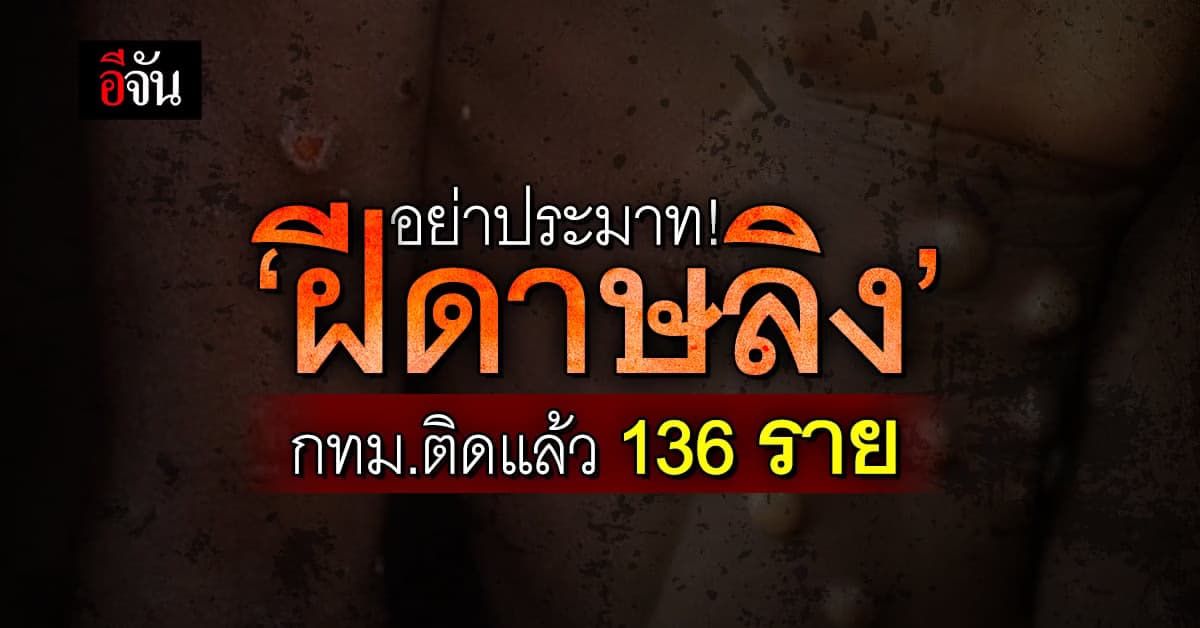 อย่าชะล่าใจ ‘ฝีดาษลิง’ กทม.พบแล้ว 136 ราย อึ้ง! มีติดเอชไอวีร่วมด้วย