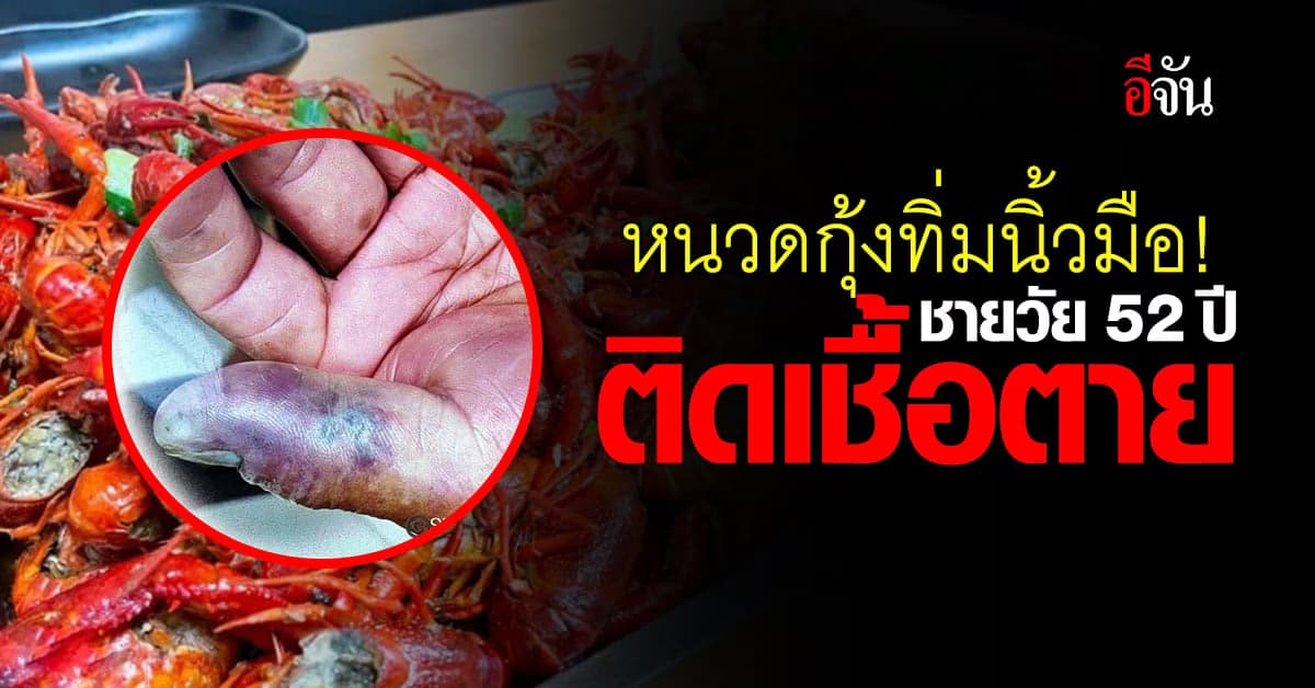 ชายชาวจีนวัย 52 ปีอยากกินกุ้ง แต่โดนหนวดกุ้งทิ่มนิ้วมือติดเชื้อตาย