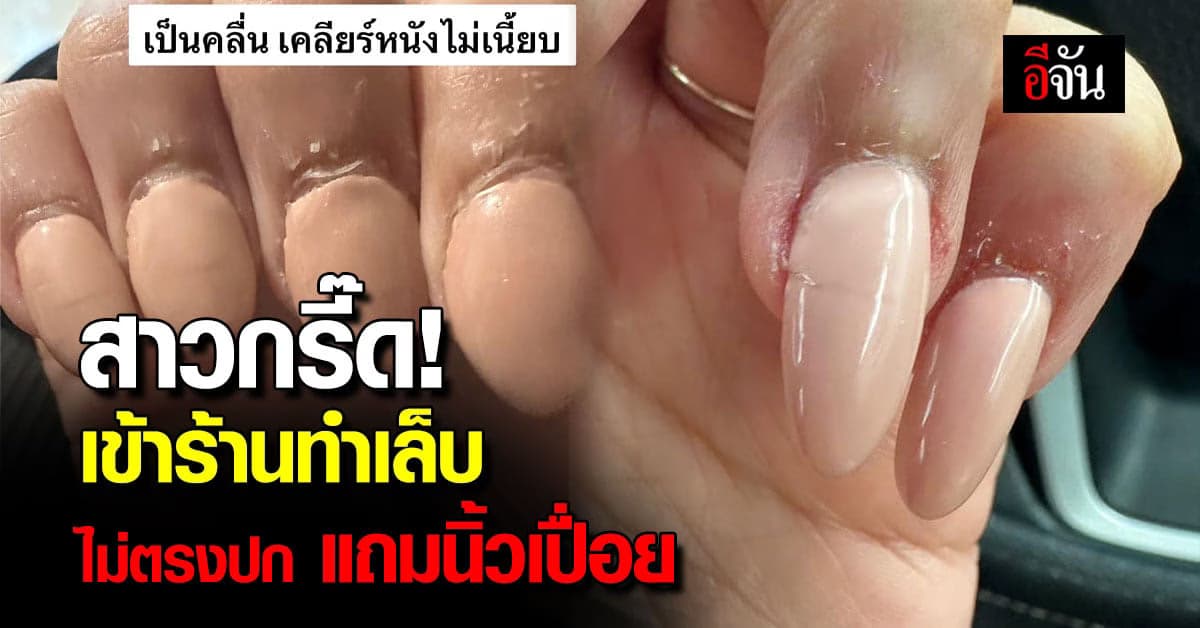 สาวช็อค! ร้านทำเล็บไม่ตรงปก แถมนิ้วเปื่อยเป็นแผล