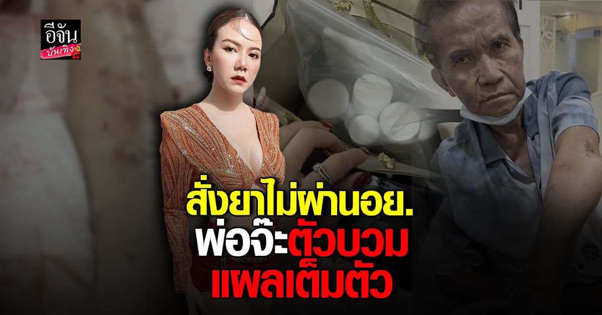 ​จ๊ะ นงผณี พาพ่อหาหมอด่วน หลังมีอาการแพ้สเตียรอยด์ แผลเต็มตัว