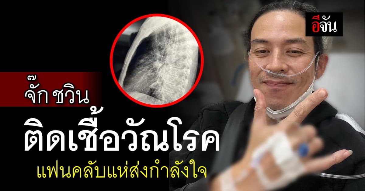 จั๊ก ชวิน ติดเชื้อวัณโรค หลังคลุกคลีเพื่อนที่ป่วยโรคนี้