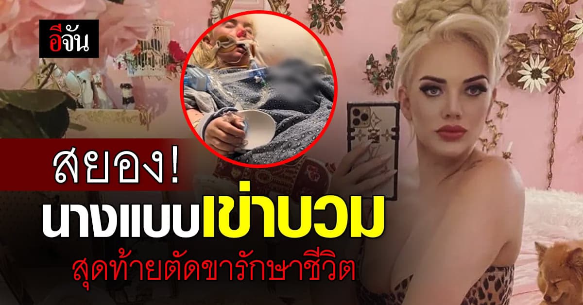 สยอง! นางแบบเข่าบวมติดเชื้อแบคทีเรียกินเนื้อ สุดท้ายตัดขารักษาชีวิต