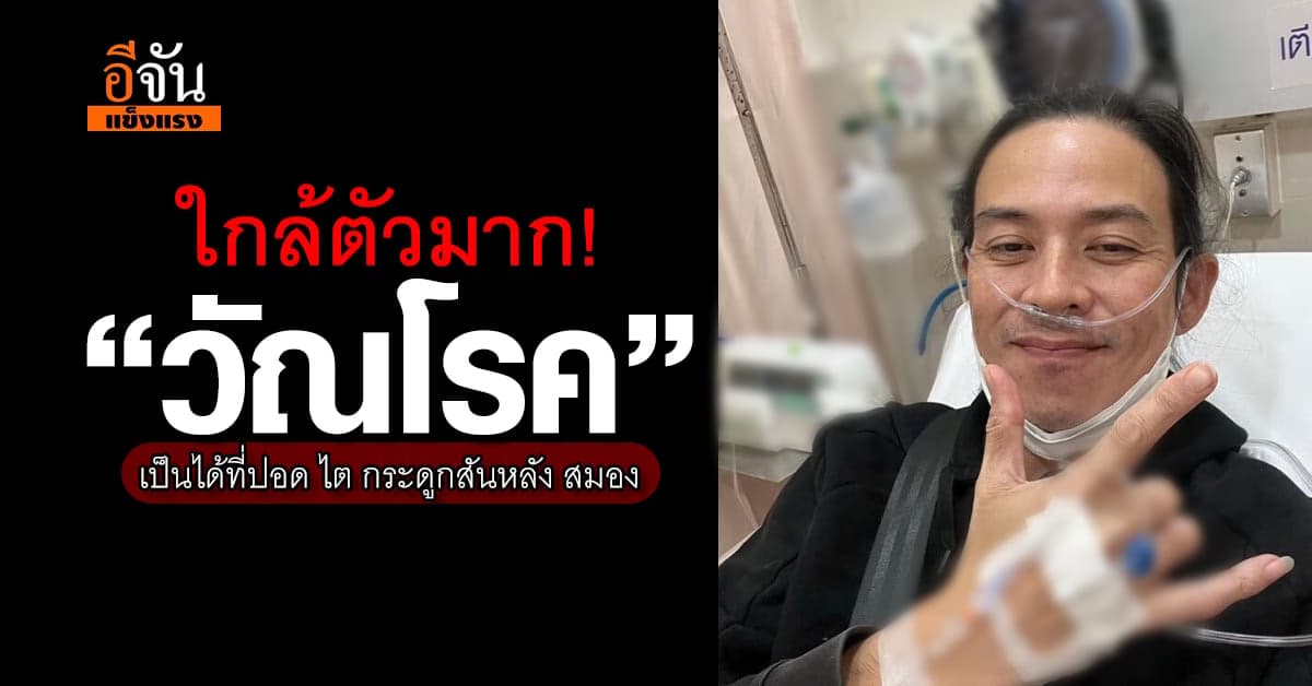 ใกล้ตัวมาก! “วัณโรค” เป็นได้ที่ปอด ไต กระดูกสันหลัง สมอง
