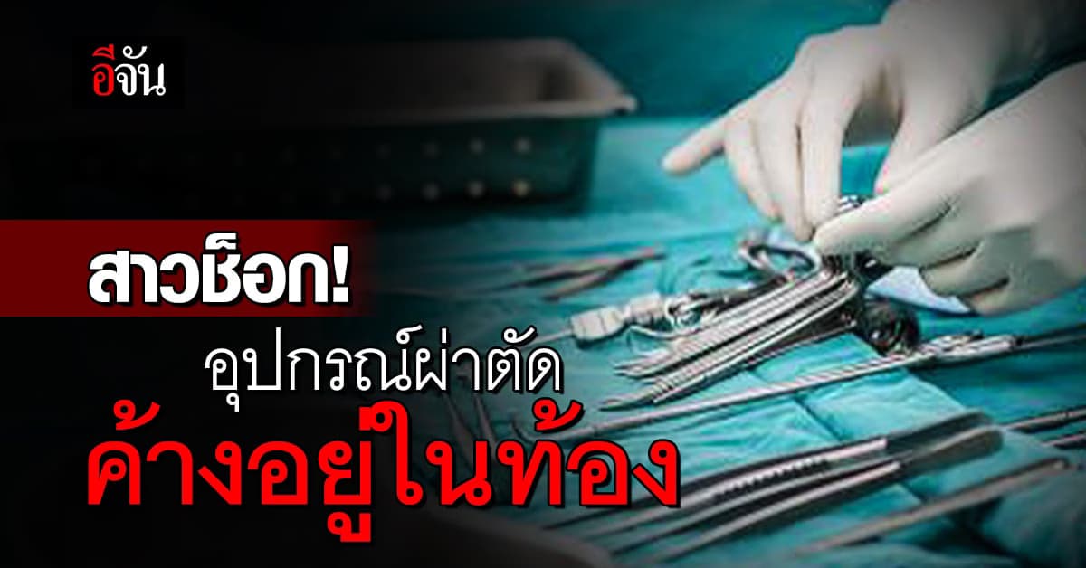 ช็อกทั้งโลก! แพทย์ลืมเครื่องมือผ่าตัดขนาดเท่าจานข้าว ไว้ในท้องคนไข้