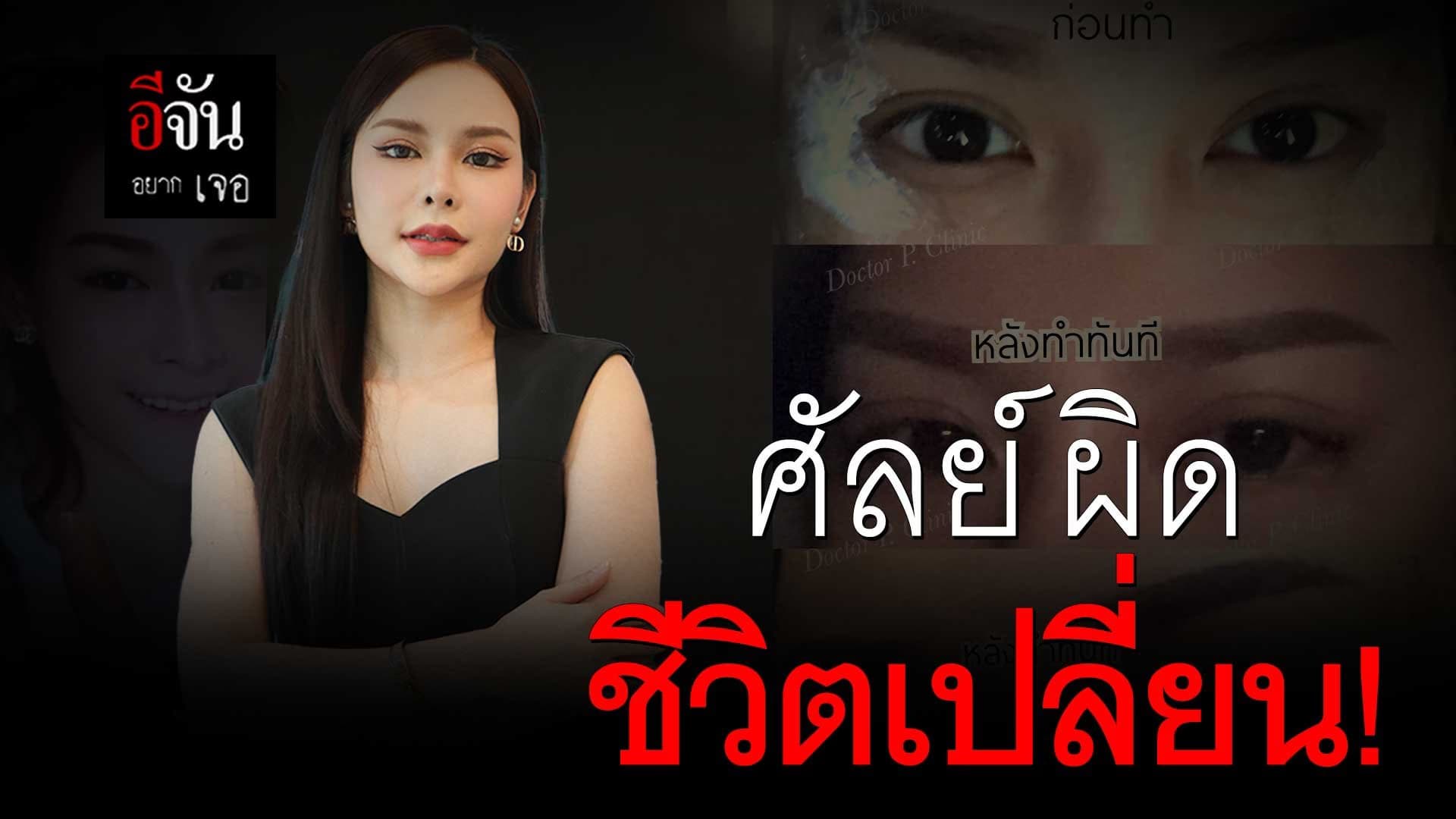 🎬 ศัลย์ผิดชีวิตเปลี่ยน