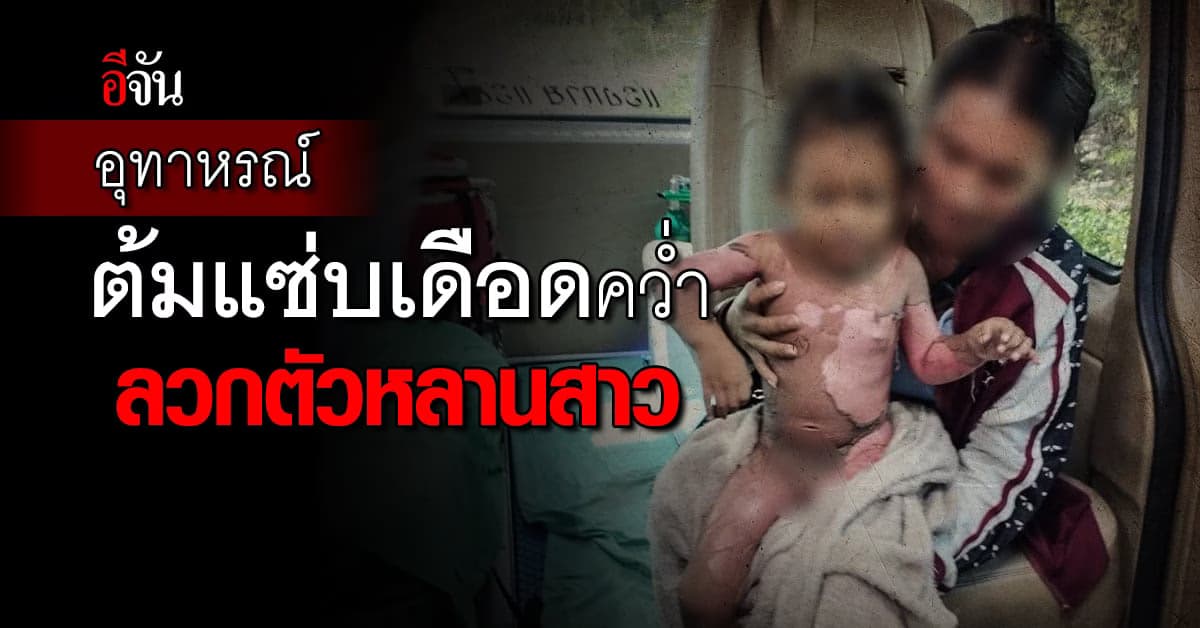 อุทาหรณ์ หม้อต้มแซ่บเดือดๆ คว่ำหกลวกตัวหลานสาว