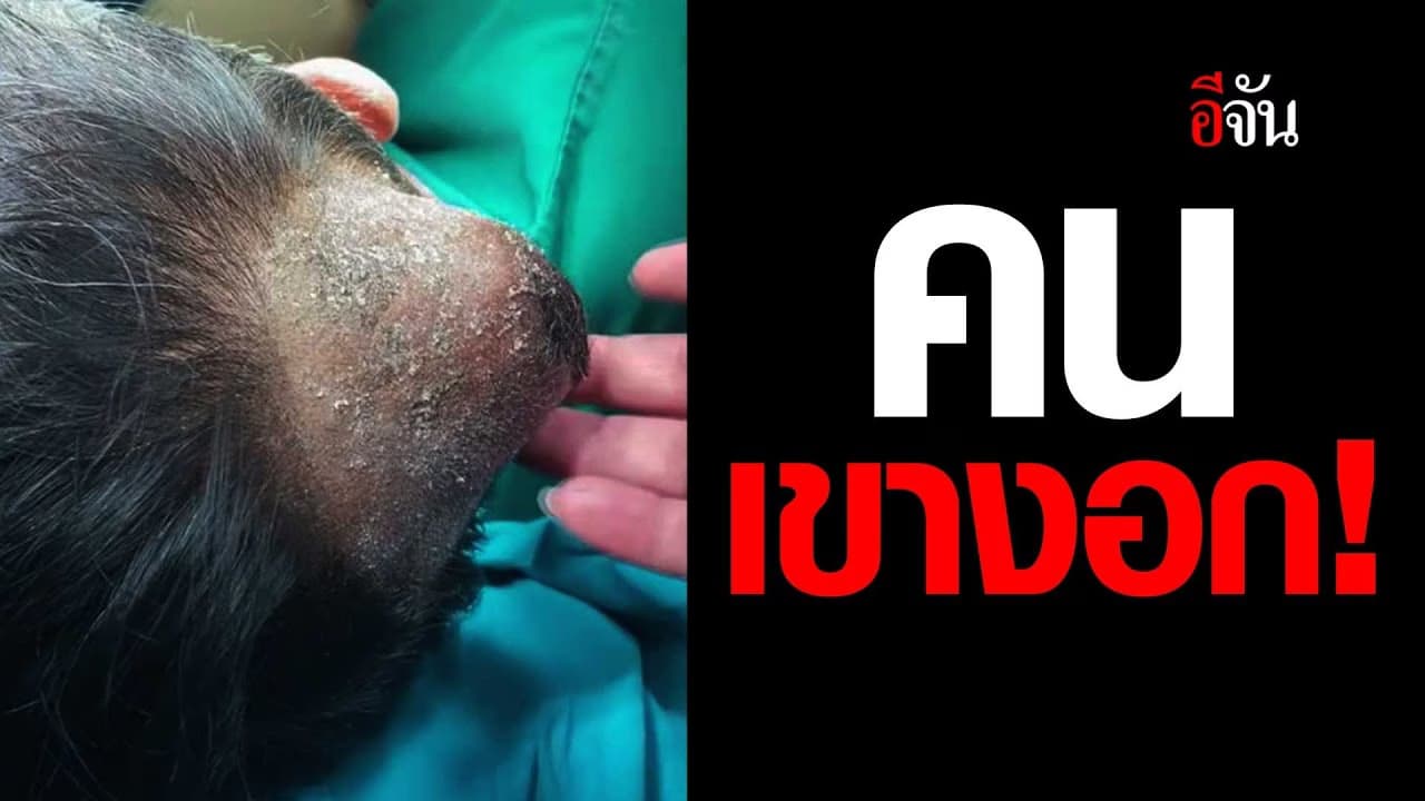 🎬 ถ้าไม่อยากเขางอก อย่าติดเหล้า