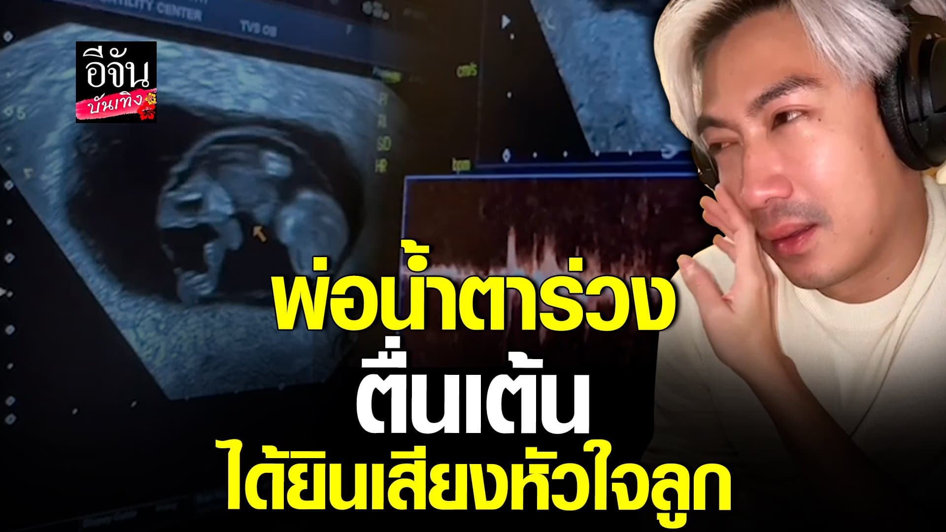 🎬 คลิปบันเทิง : เป๊ก เปรมณัช น้ำตาแตกได้ยินเสียงหัวใจลูกในท้อง นิว