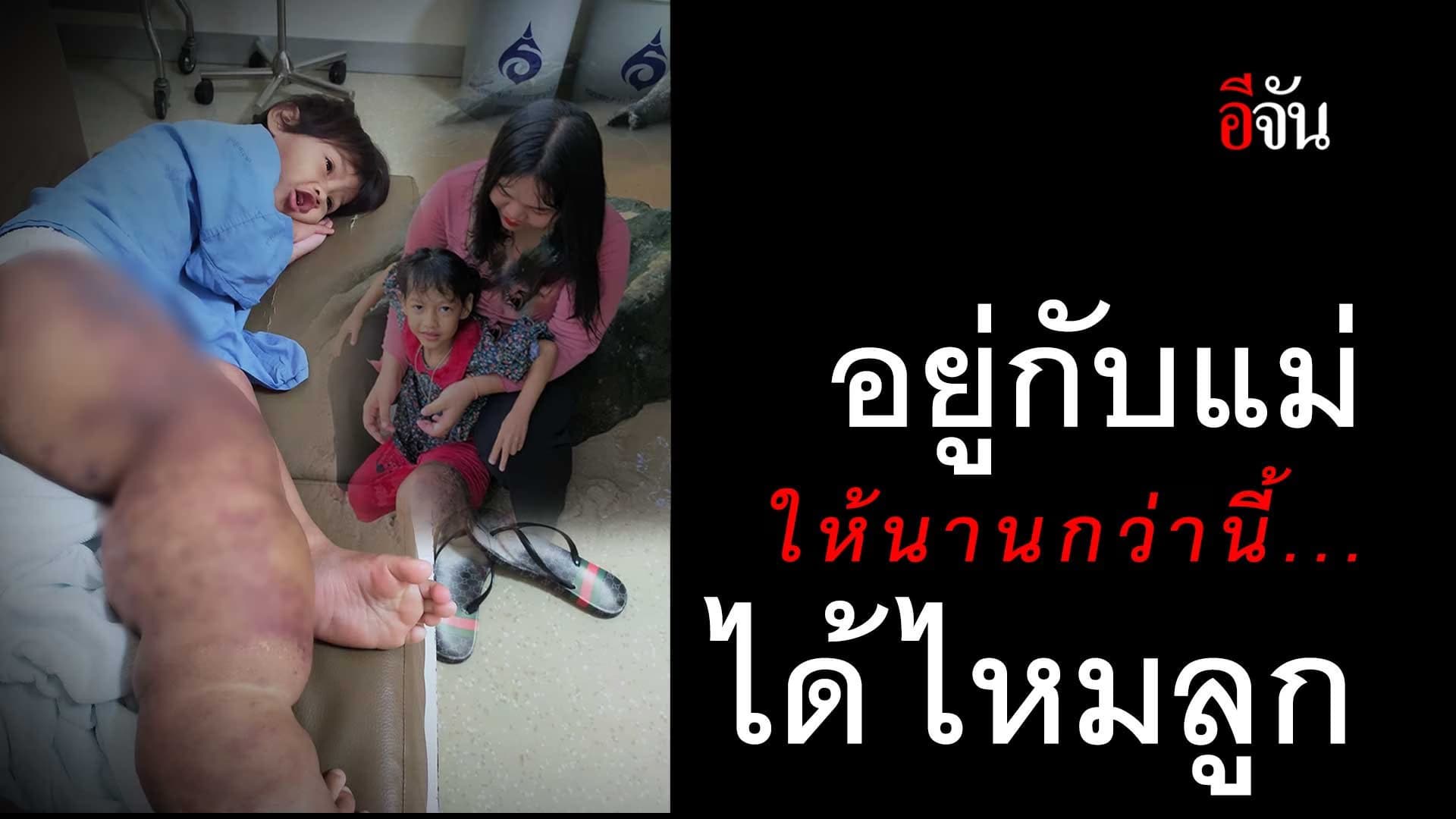 🎬 พ่อแม่ ต้องดู! เด็กคนนี้ “ขาใหญ่” ตั้งแต่อยู่ในท้อง