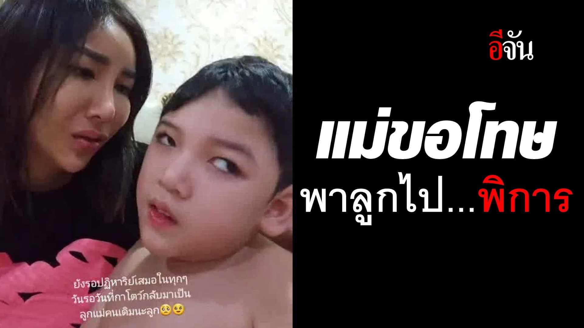 🎬 แม่ร้องไห้ โทษตัวเองทุกวัน ที่พาลูกชาย 2 เดือน ไปพิการ