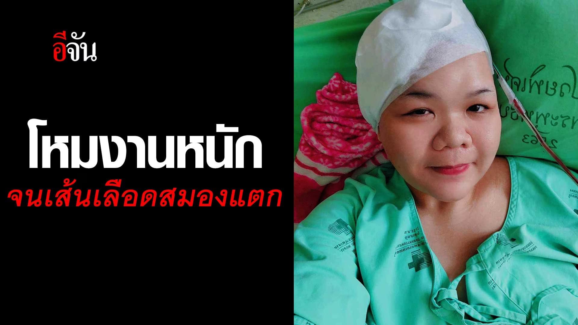 🎬 โหมงานหนัก จนเส้นเลือดสมองแตก