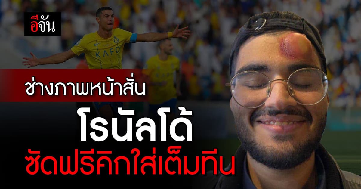 ช่างภาพดวงซวย โชว์แผลหัวปูด หลังโดน โรนัลโด้ ซัดฟรีคิกใส่