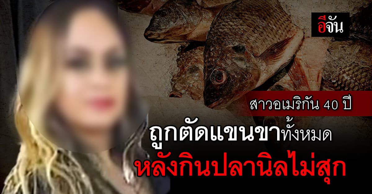 สยอง! สาวอเมริกัน วัย 40 ปี ต้องตัดแขนขาทิ้ง หลังกินปลานิลปรุงไม่สุก