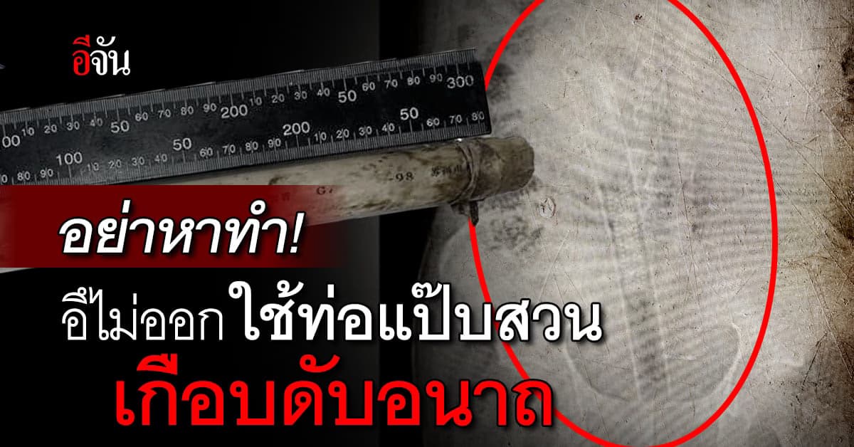 หาทำอีกแล้ว! ชายวัย 65 อึไม่ออก พิเรนทร์ใช้ท่อแป๊ปสวนก้น หวิดดับ