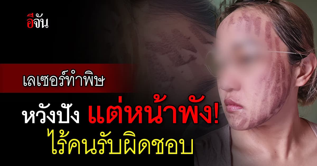 อุทาหรณ์! พิธีกรสาว ทำเลเซอร์หน้าใส ได้หน้าพัง ไร้คนรับผิดชอบ