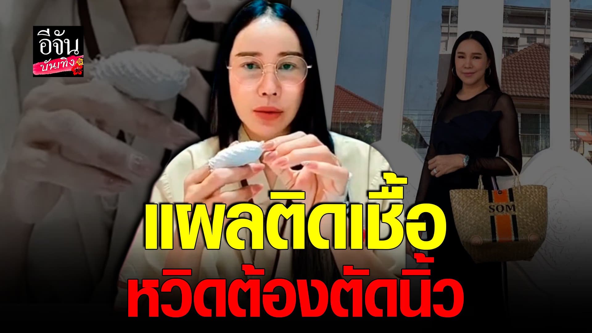 🎬 คลิปบันเทิง : ส้มเช้ง สามช่า แชร์ประสบการณ์ แผลติดเชื้อรุนแรง