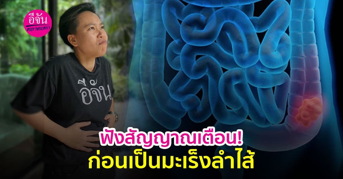 เตือนแล้วนะ! อย่ามองข้าม สัญญาณเตือน คุณกำลังเป็นมะเร็งลำไส้