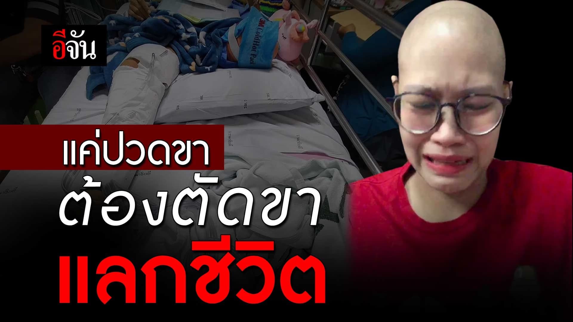 🎬 คลิปโซเชียล แค่ปวดขา ต้องตัดขาแลกชีวิต