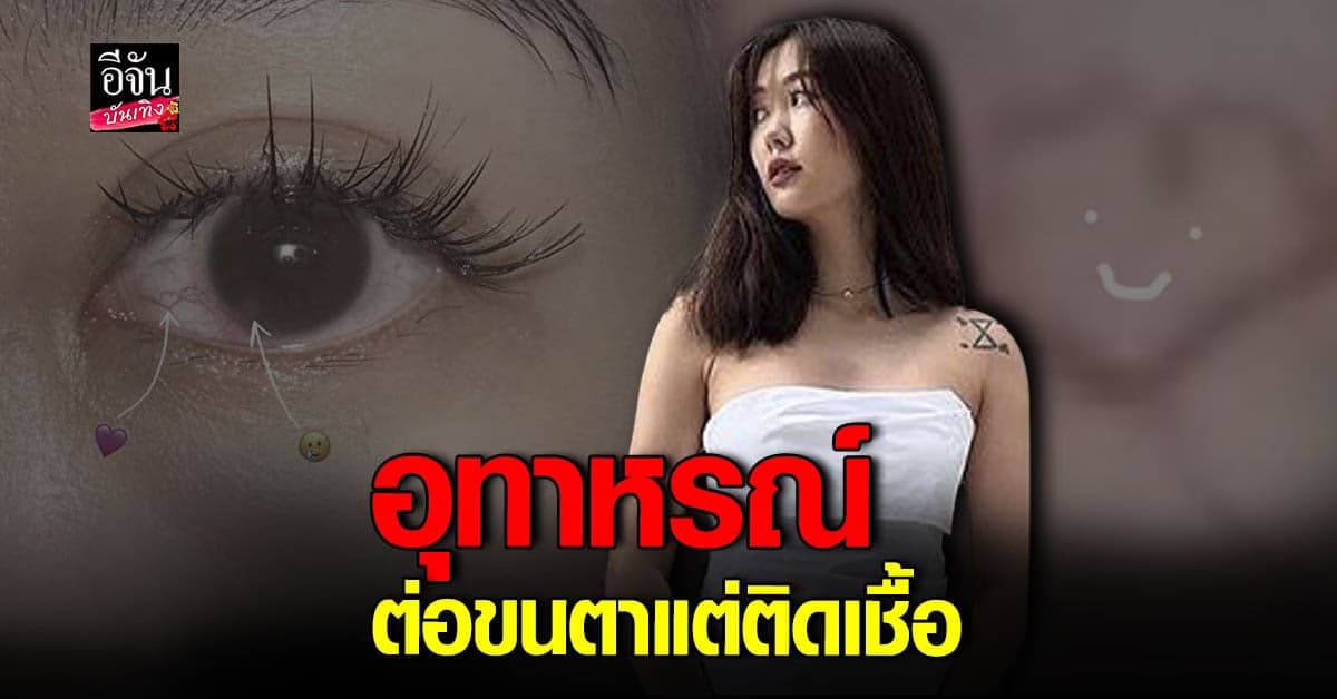 อุทาหรณ์! ยิปโซ ต่อขนตา แต่กระจกตาติดเชื้อ