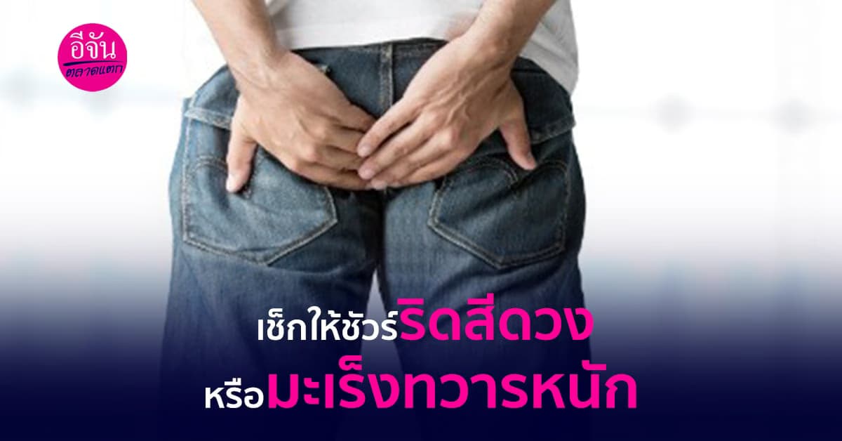 เช็กให้ชัวร์ว่าเราเป็นริดสีดวง หรือมะเร็งทางทวารหนักกันแน่