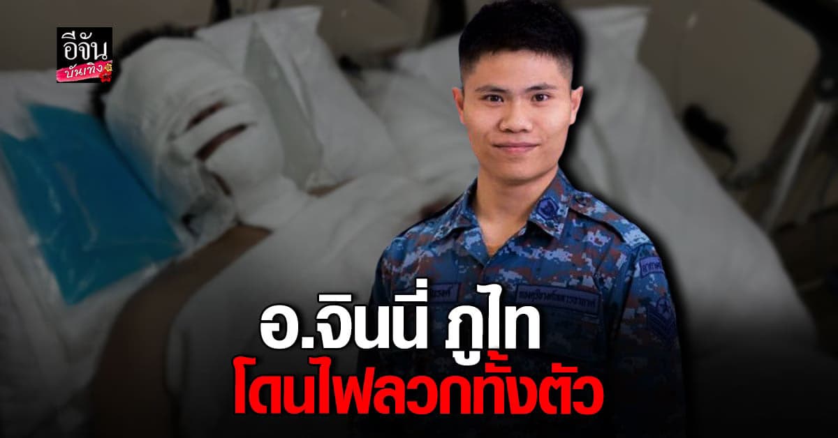 อุ๋งอิ๋ง ภรรยา อ.จินนี่ ภูไท แจ้งข่าว สามีโดนไฟลวกทั้งตัว