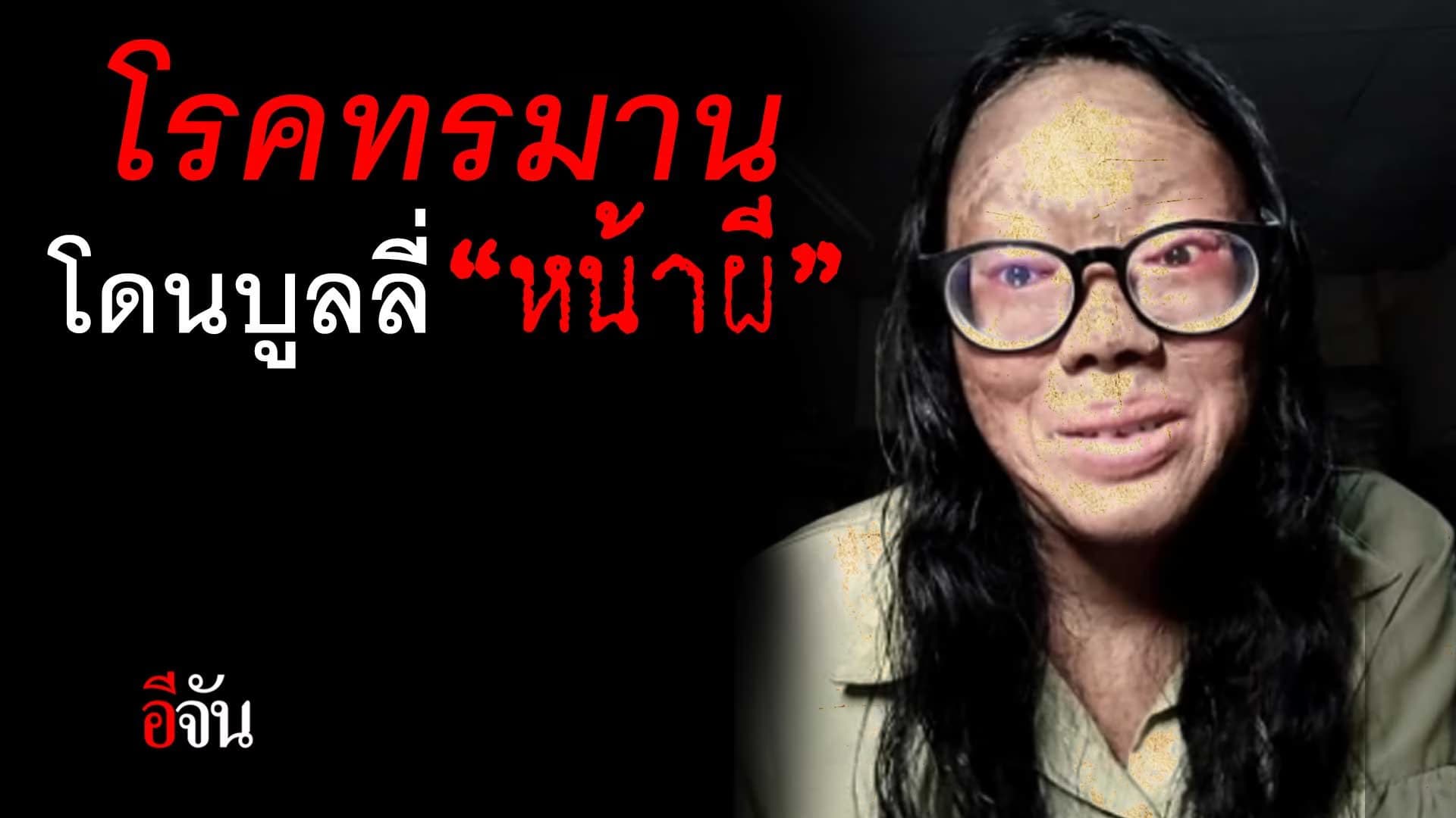 🎬 โรคทรมาน จองจำชีวิต โดนบูลลี่ “หน้าผี”