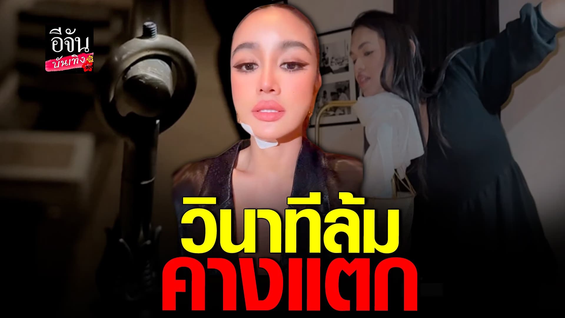 🎬 คลิปบันเทิง : กระแต อาร์สยาม เผยคลิปวินาทีล้มคางแตก เย็บ 5 เข็ม