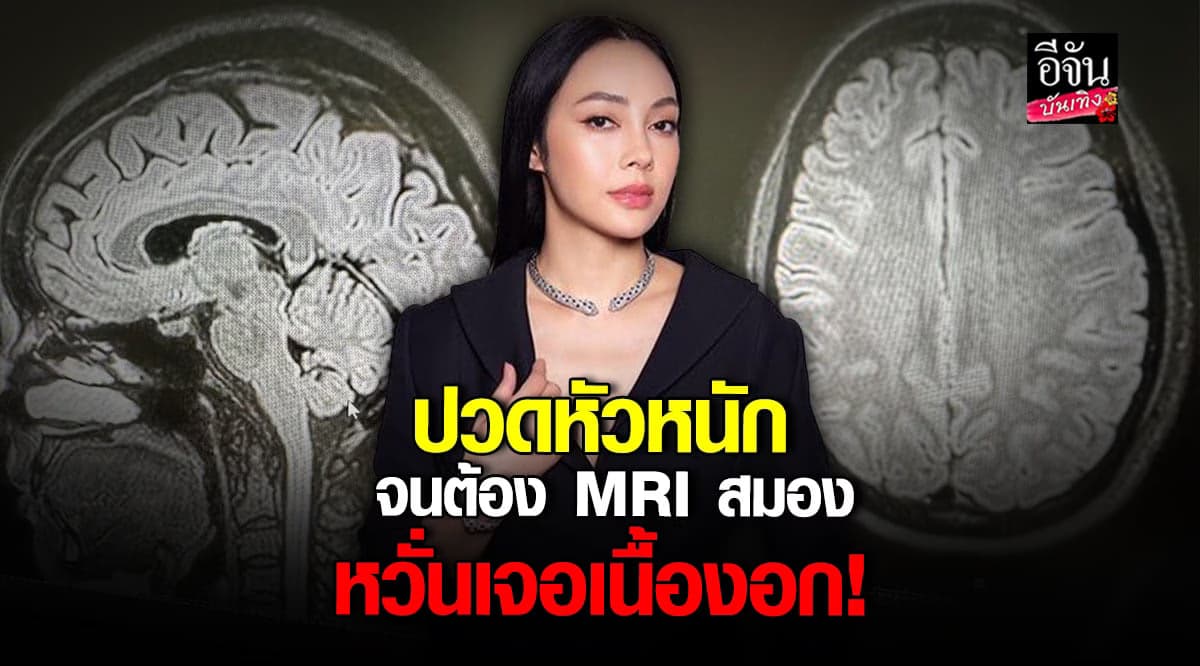 ตั๊ก บงกช เผยผลตรวจ MRI สมอง หลังปวดหัวรุนแรง