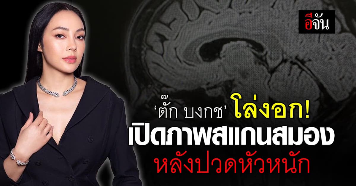 ‘ตั๊ก บงกช’ โล่งอก! เปิดภาพสแกนสมอง หลังปวดหัวหนัก นึกว่าเป็นเนื้องอก