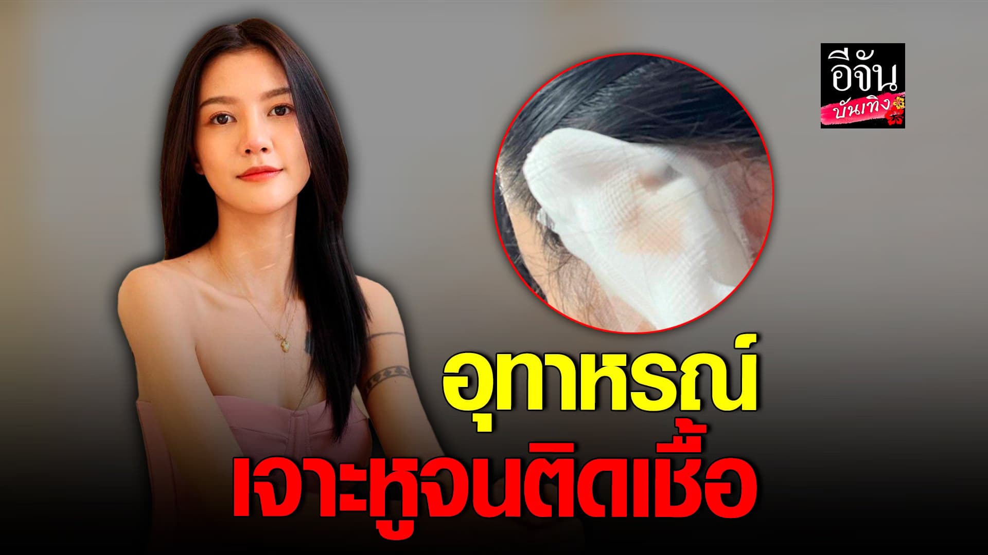 🎬 คลิปบันเทิง : เจาะหู แต่กลับติดเชื้อ จนต้องเข้าโรงพยาบาล