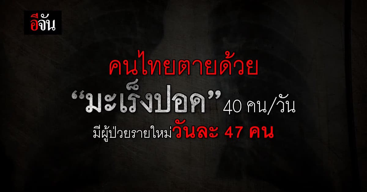 กรมการแพทย์ คนไทยตายด้วย “มะเร็งปอด” 40 คน/วัน