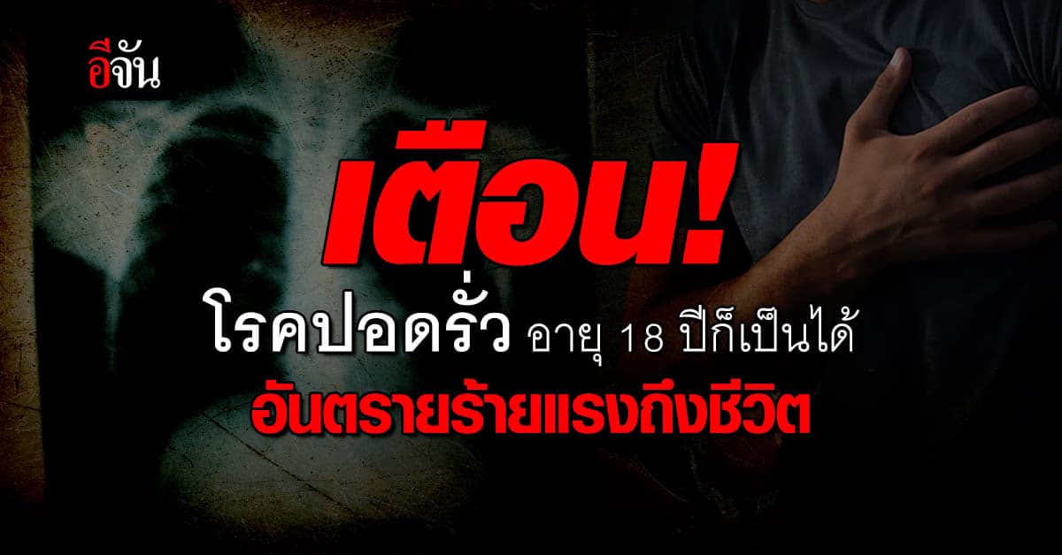 เตือน! โรคปอดรั่ว อายุ 18 ปีก็เป็นได้ อันตรายร้ายแรงถึงชีวิต