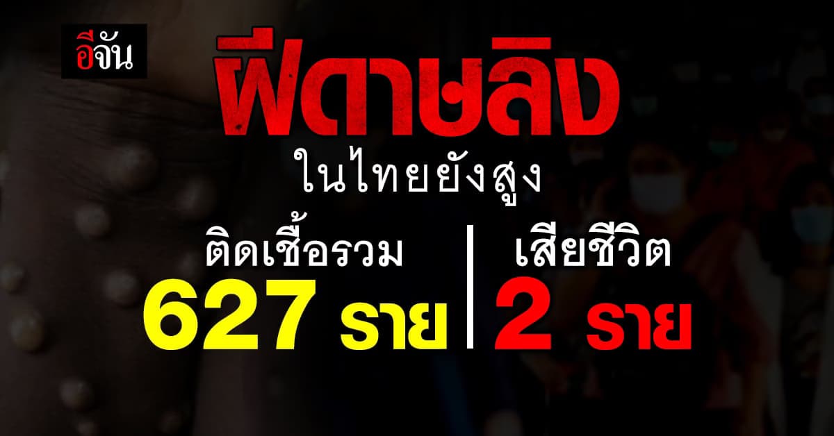 โรคฝีดาษลิง ในไทย น่าห่วง พบติดเชื้อแล้ว 627 คน เสียชีวิต 2 ราย