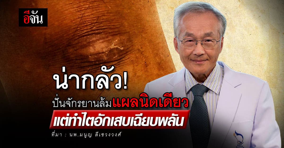 น่ากลัว! ปั่นจักรยานล้มมีแผลถลอกนิดเดียว แต่ทำไตอักเสบเฉียบพลัน