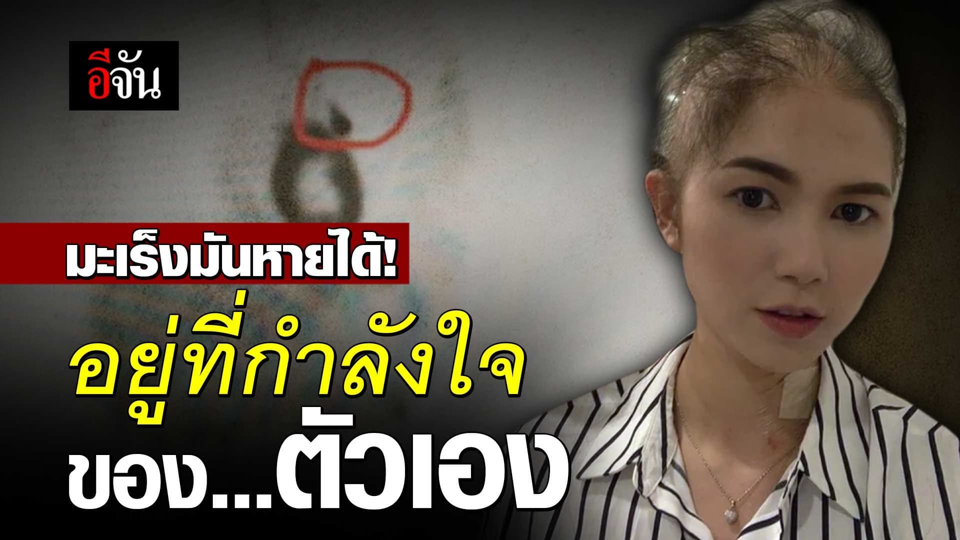 🎬 มะเร็งมันหายได้! อยู่ที่กำลังใจ ของตัวเอง