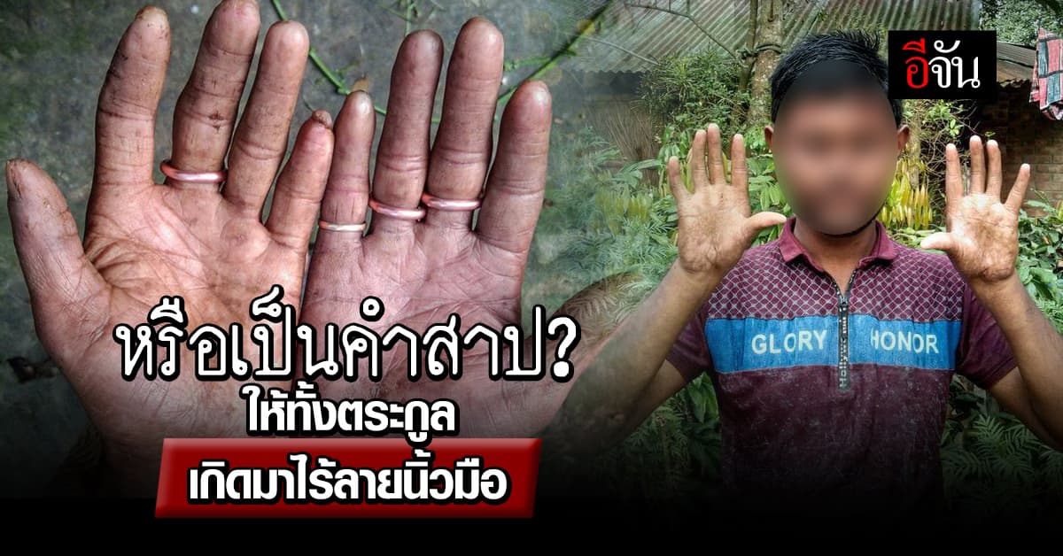 หรือเป็นคำสาป? ชาวบังกลาเทศทั้งตระกูล ไร้ลายนิ้วมือ